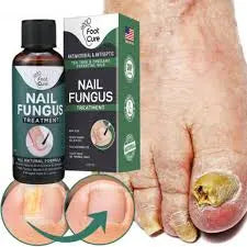 Nail Fungus Treatment